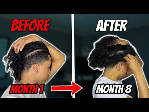 8 month UNDERCUT GROWTH JOURNEY (How to GROW your UNDERCUT QUICK)